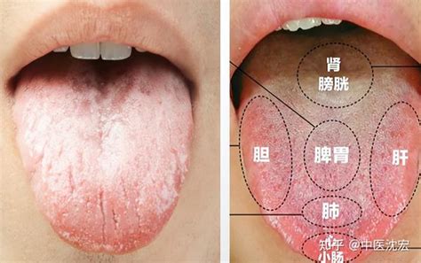 舌苔薄白|舌苔发白、且厚腻？可能是身体在传递3个信息，别不。